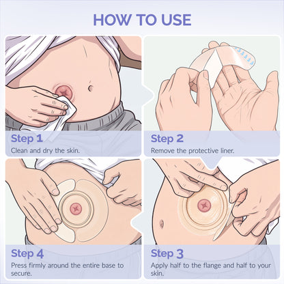 20 PCS Ostomy Barrier Strips, Elastic Colostomy Tape to Stop Leaks, for Colostomy Ileostomy Bags Pouches