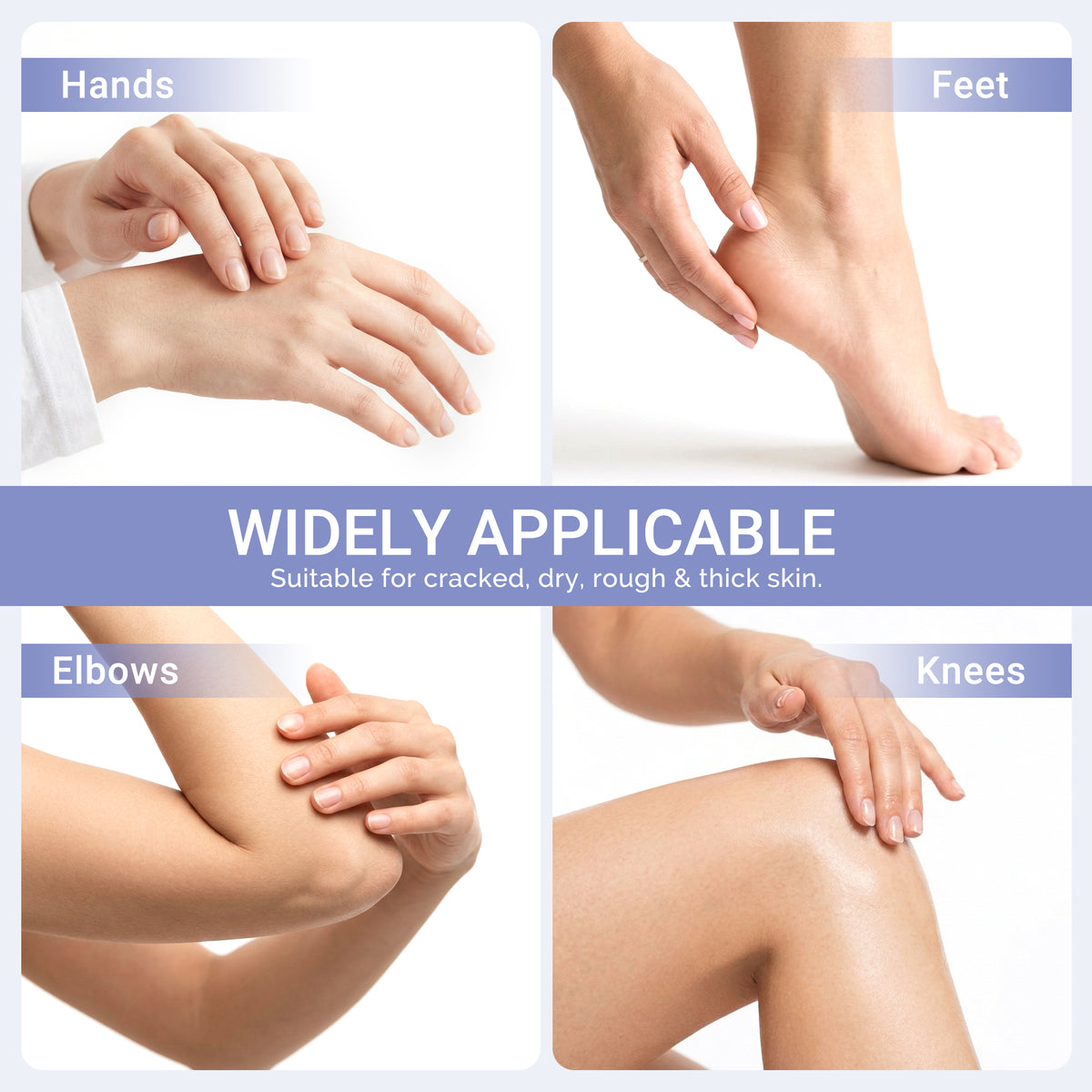 Vexipien 40% Urea Cream with 2% Salicylic Acid Foot Care, 150g